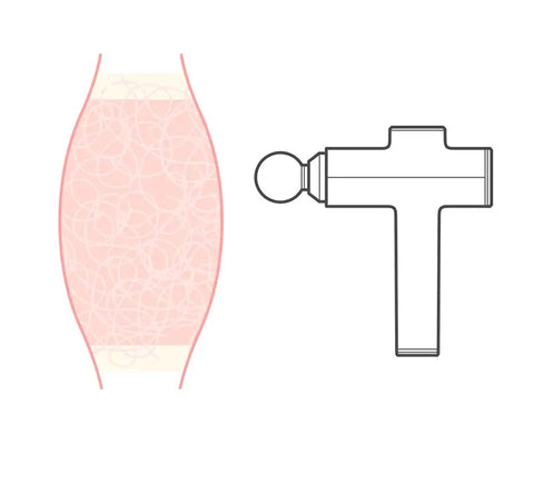 Image of Portable Electric Muscle Massager
