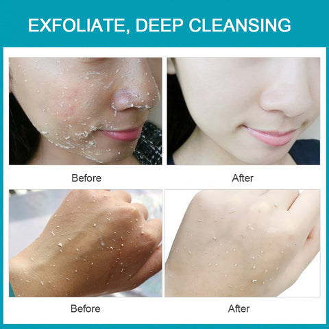 Image of Exfoliating Peeling Gel