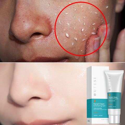 Image of Exfoliating Peeling Gel