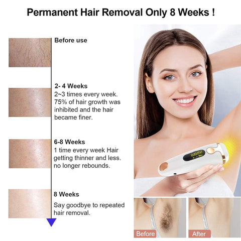 Image of Silk Touch Pro™ IPL Hair Removal Device