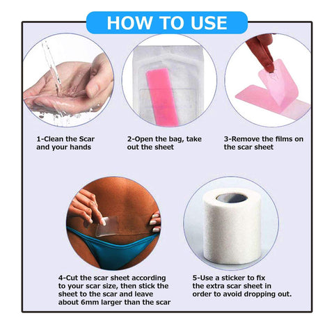 Image of MIRACLE STRETCH MARK + SCAR REMOVAL SHEETS