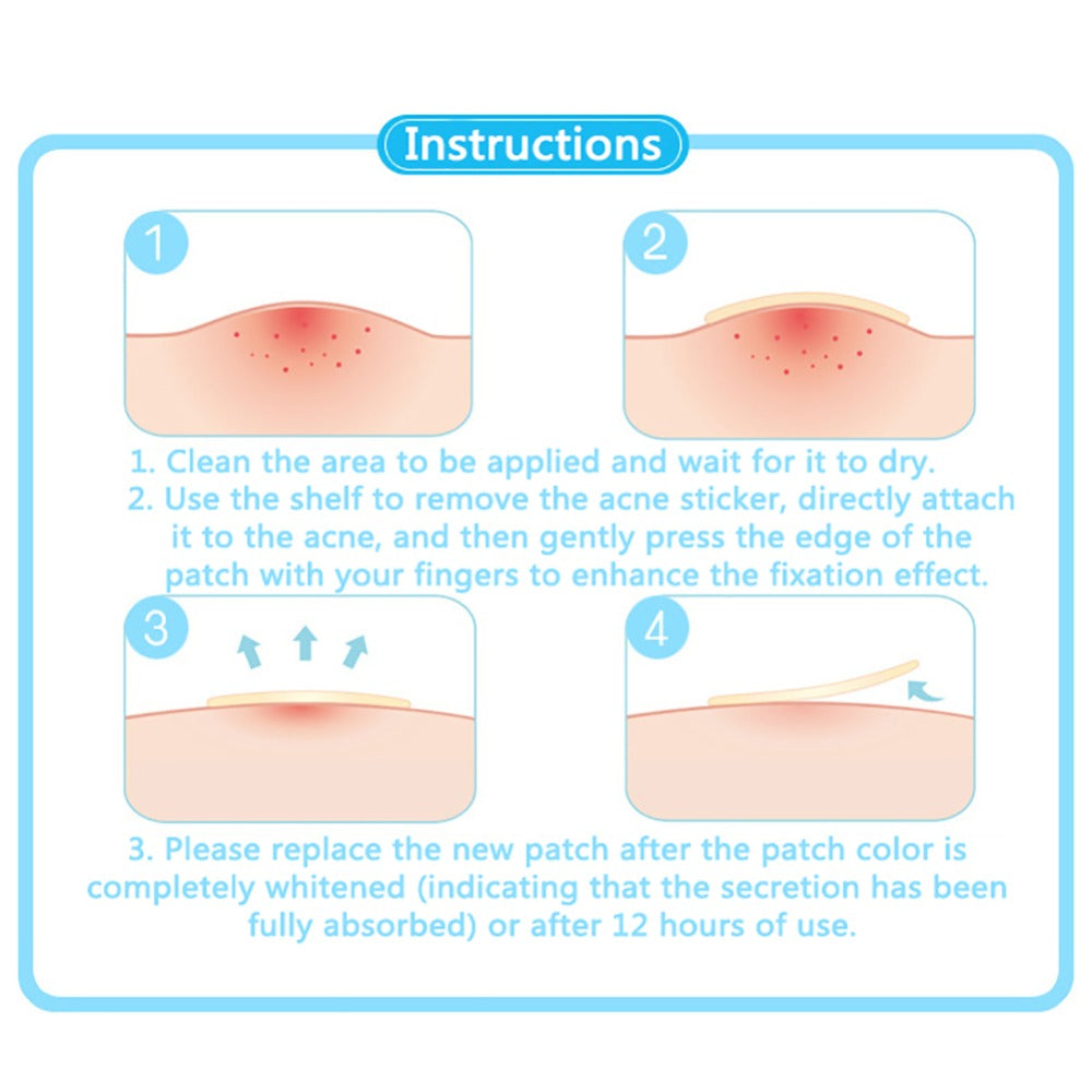 Beauty Acne Patch Set (24 PCS)