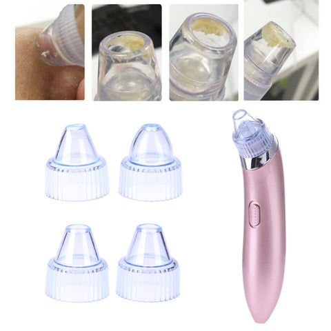 Image of Comedone Vacuum Pro