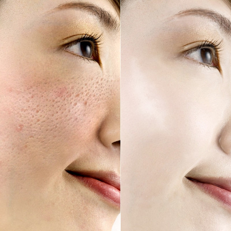 ROREC Hyaluronic Acid Ampoule Face Serum