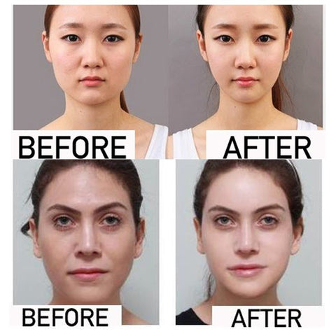 Image of Miracle V-Shaped Slimming Mask