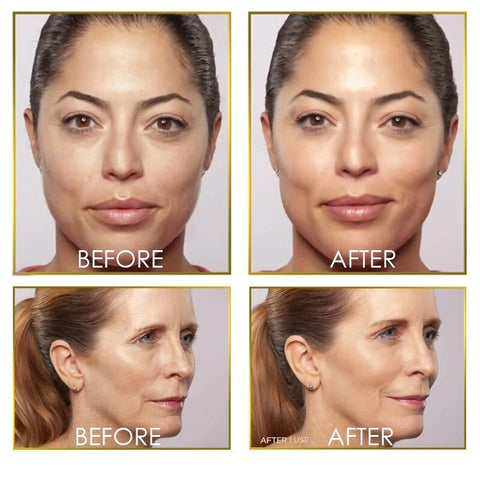 Image of Dermaplane Face Hair Remover