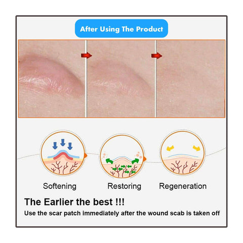 Image of MIRACLE STRETCH MARK + SCAR REMOVAL SHEETS