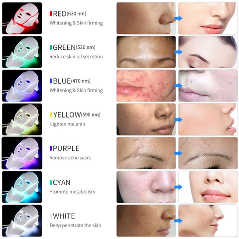 Image of Therapy Acne Mask