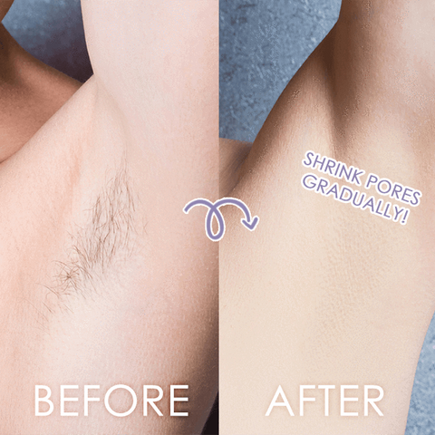 Image of Perfect Hair Remover