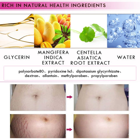 Image of Mango Stretch Mark Cream For Pregnancy Repair