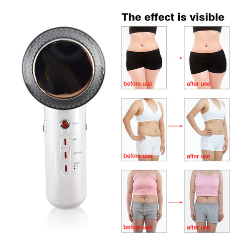 Image of Ultrasonic Cavitation Slimming Machine