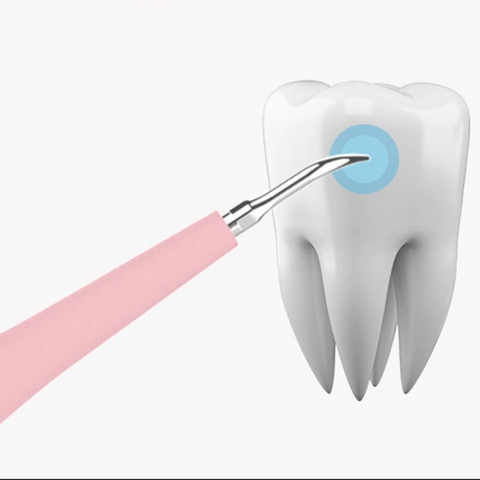 Image of Electric Dental Calculus Remover