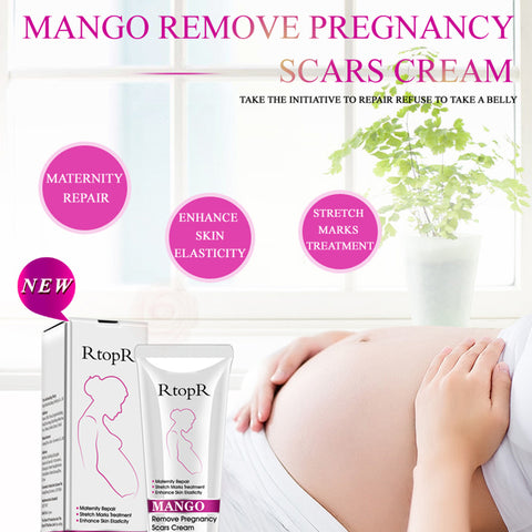 Image of Mango Stretch Mark Cream For Pregnancy Repair