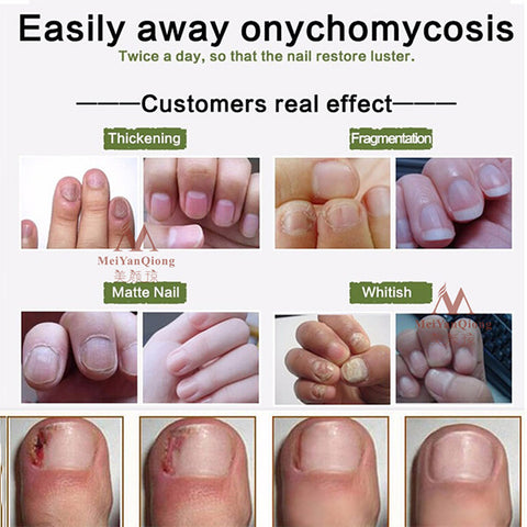 Image of Nail Repair Cream