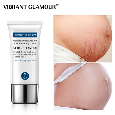 Image of VIBRANT GLAMOUR Crocodile Stretch Marks Remover Cream