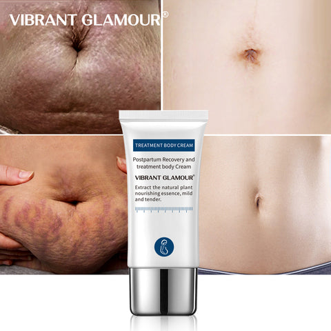 Image of VIBRANT GLAMOUR Crocodile Stretch Marks Remover Cream