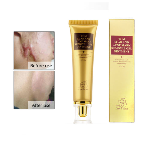 Image of ACNE SCAR CREAM