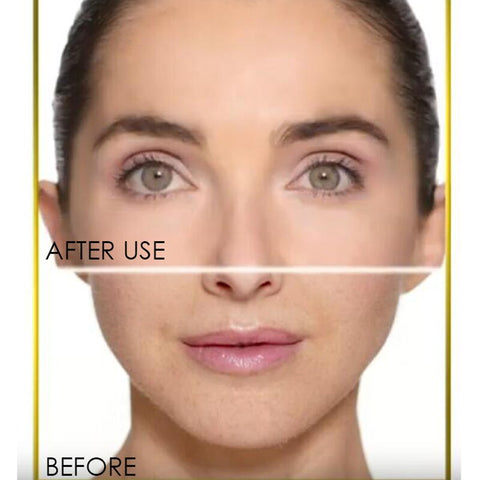Image of Dermaplane Face Hair Remover