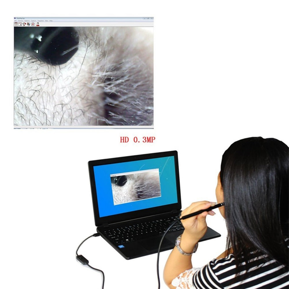 Earpick Camera