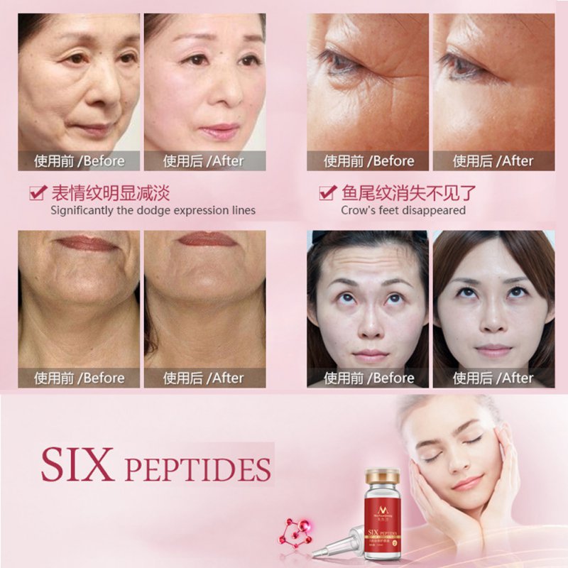Anti Wrinkle Serum