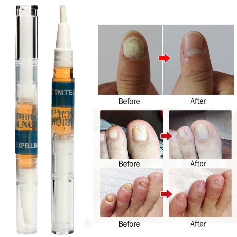 Eucony Fast Acting Toenail Cure - 3ml (PACK OF 4)