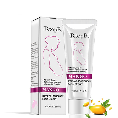 Image of Mango Stretch Mark Cream For Pregnancy Repair
