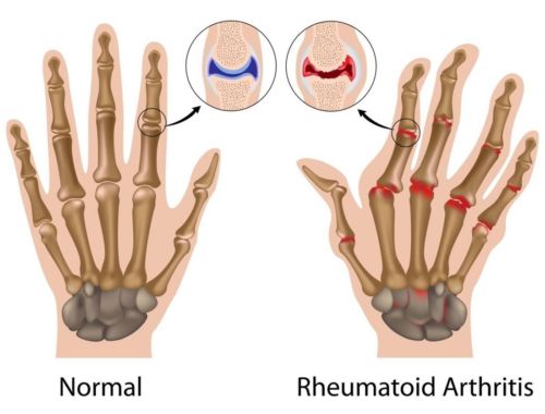 Copper Compression Therapy Hand Gloves