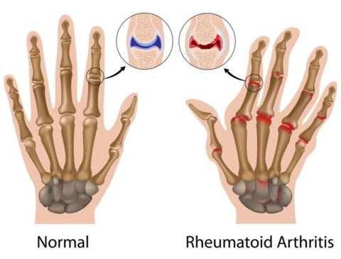 Image of Copper Compression Therapy Hand Gloves