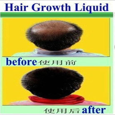 Image of The Organic Hair Growth Essence