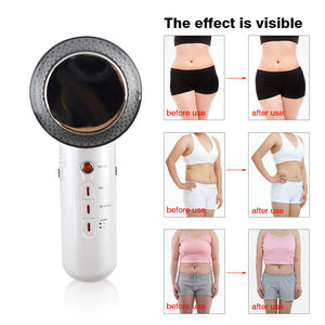 Ultrasonic Cavitation Slimming Machine