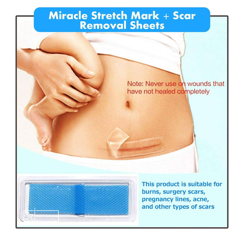 Image of MIRACLE STRETCH MARK + SCAR REMOVAL SHEETS
