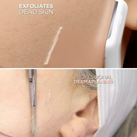 Image of Dermaplane Face Hair Remover